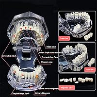 Vista 4 de Reparación neural Modelo dental Enfermedad del implante Modelo de dientes Dentista Estándar Patológico Dientes removibles Modelo de enseñanza