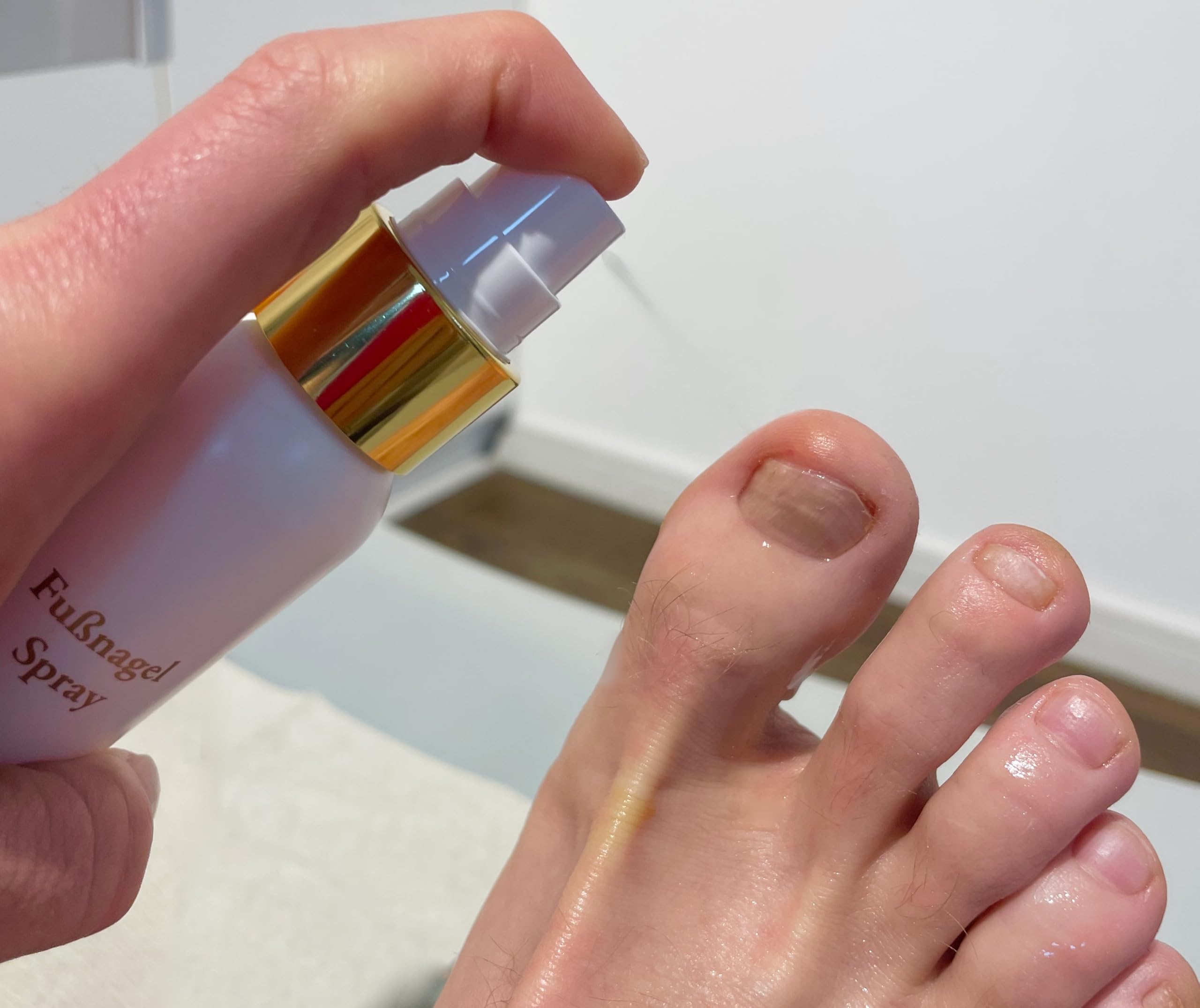 Spray pour les ongles des pieds, convient également pour les ongles
