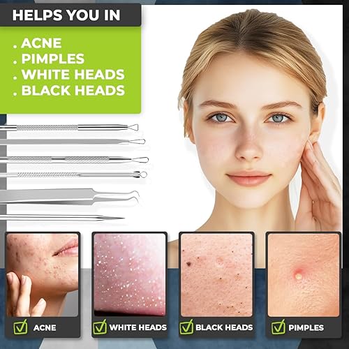 Miniatura 2 de 6 piezas Herramientas para eliminar puntos negros para el acné, kit de herramientas quirúrgicas de acero inoxidable para reventar, kit de extracción