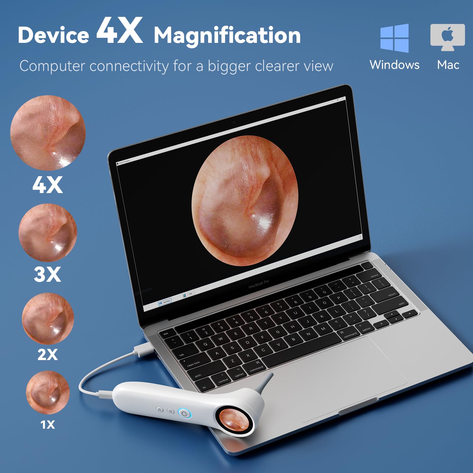 1080P HD Otoscope - Clear Ear View -6