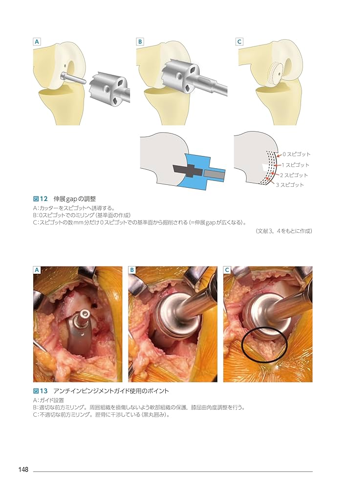 動画で学ぶ 患者さん満足度向上のためのTKA・UKA インプラント