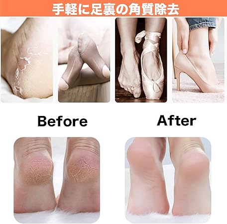 Amazon かかと削り 角質除去道具 角質取り フットファイル 足ヤスリ ナノガラス製 丸洗いok 乾湿足用 改良版 Tribetter 魚の目削り 角質やすり 通販 Amazon かかと削り 角質除去道具 角質取り フットファイル 足ヤスリ ナノガラス製 丸洗いok 乾湿足用 改良版 Tribetter 魚の目削り 角質やすり 通販