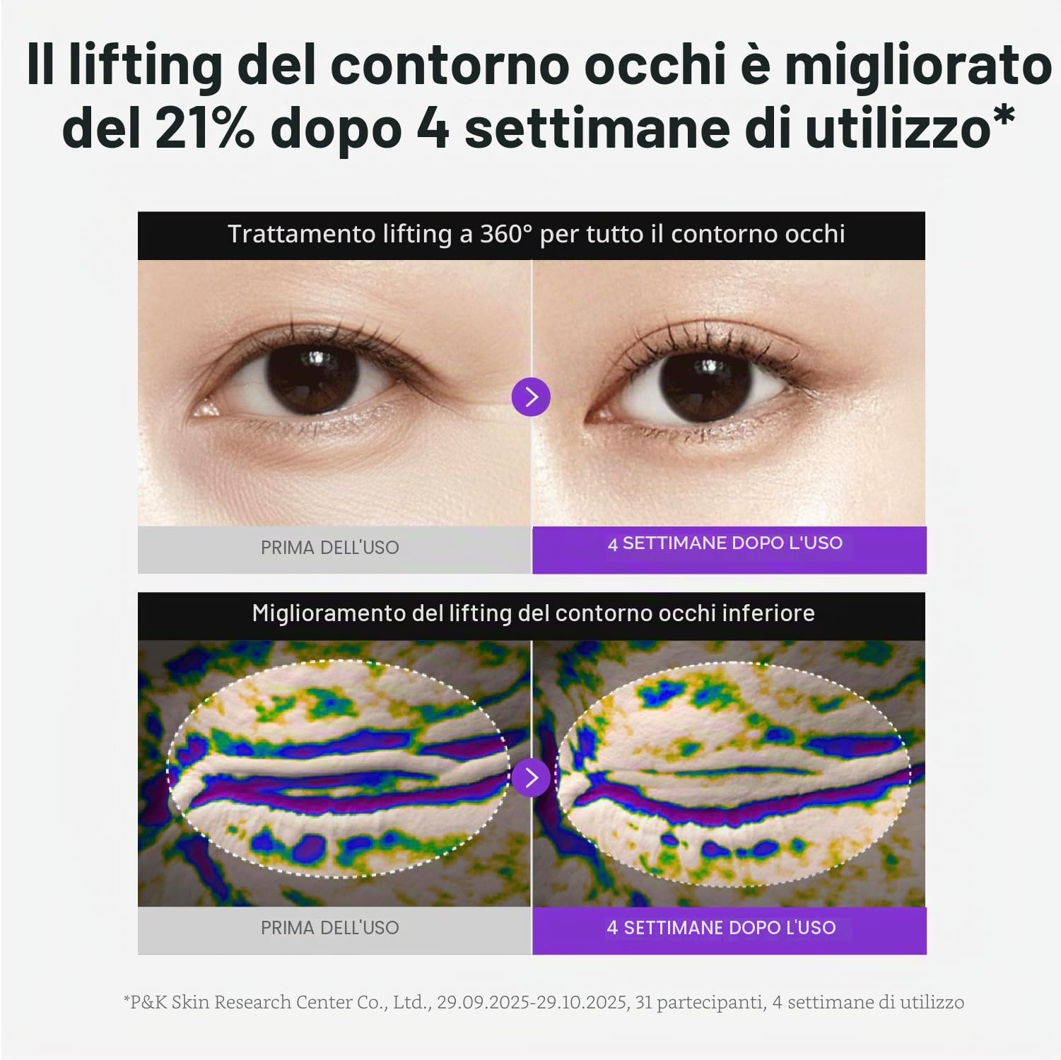 Centellian24 360 Shot PDRN Crema contorno occhi rassodante 30 ml – Crema contorno occhi al retinolo anti-età per occhi cadenti, levigante delle rughe, cura rassodante e idratante per borse sotto gli