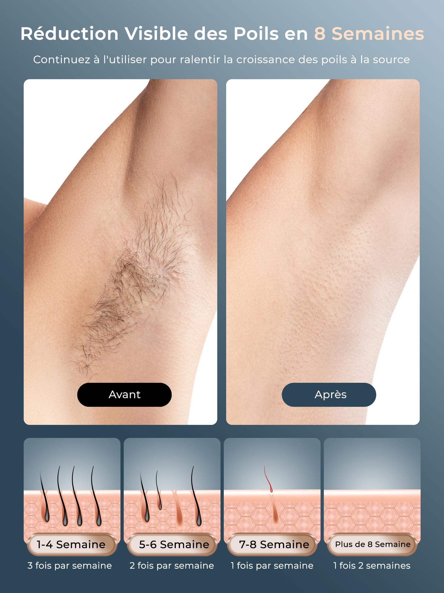 Épilateur Lumière Pulsée avec Fonction de Refroidissement, Épilation Laser sans Douleur avec 9 Niveaux D'énergie pour Femmes et Hommes, Visage, Aisselles, Bikini, Jambes, Corps, Blanc