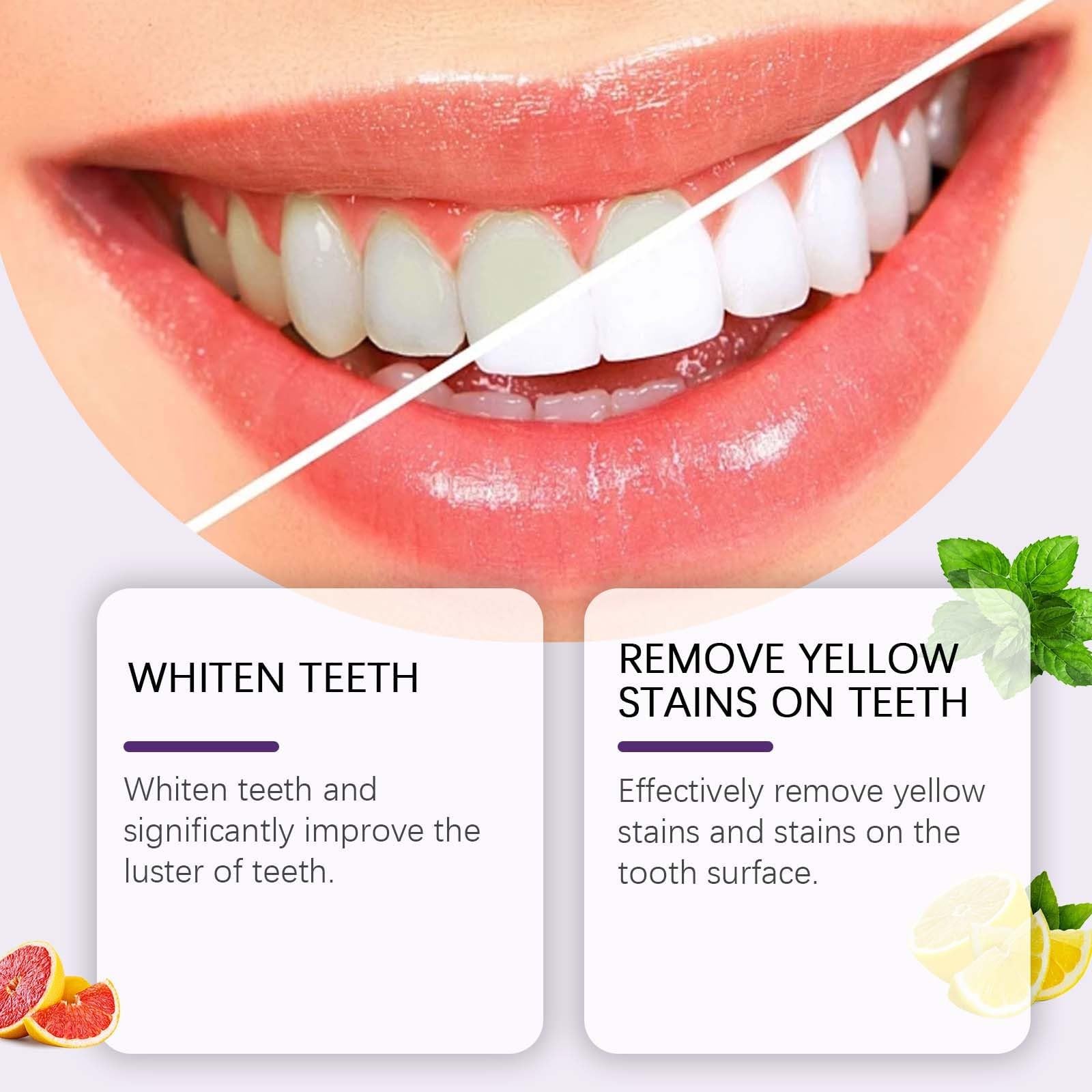 Dentifricio Sbiancante Intensivo 7-Pro, Formula Viola Potenziata con 7 Probiotici, Riparazione dello Smalto e Alito Fresco, per la Rimozione Profonda delle Macchie