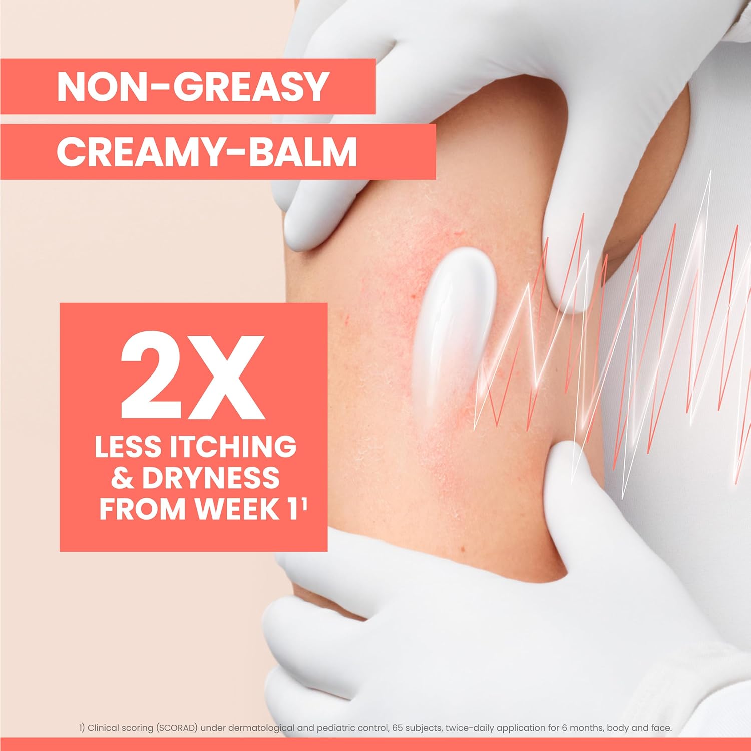 Avène XeraCalm A.D Lipid-Replenishing Balm, Atopic Dermatitis, Eczema-Prone Skin, For dry, itchy Skin, Restore Skin Barrier, Infants, Children & Adults, No Preservatives, Fragrance-Free