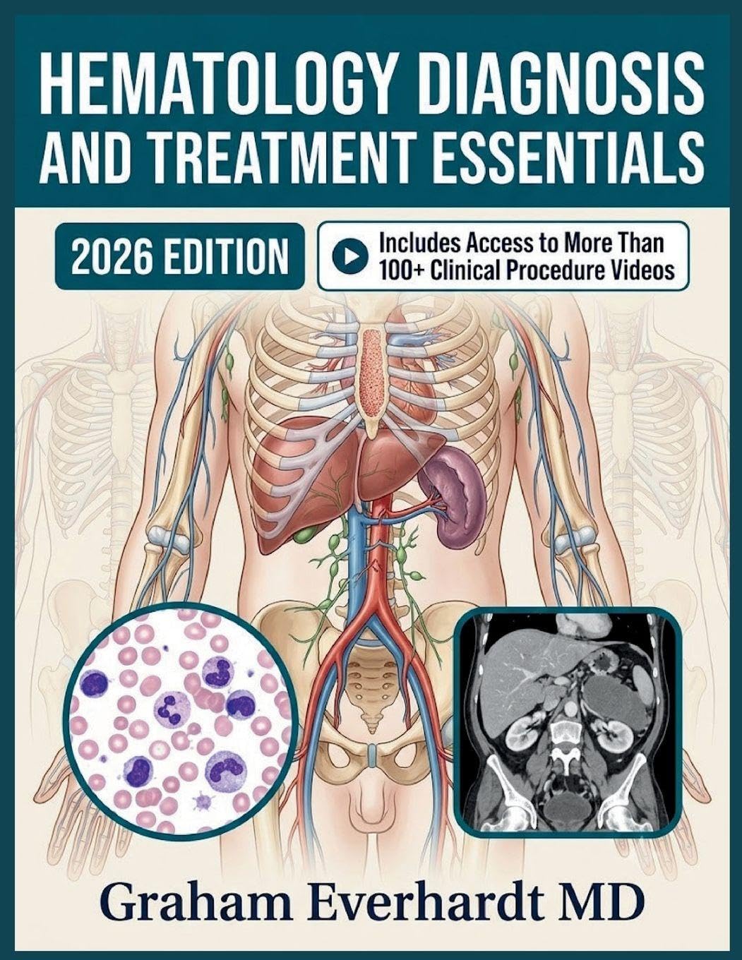 HEMATOLOGY DIAGNOSIS AND TREATMENT ESSENTIALS: A Clinical Guide to Anemias, Bleeding Disorders, and Blood Cancers with Management Workflows