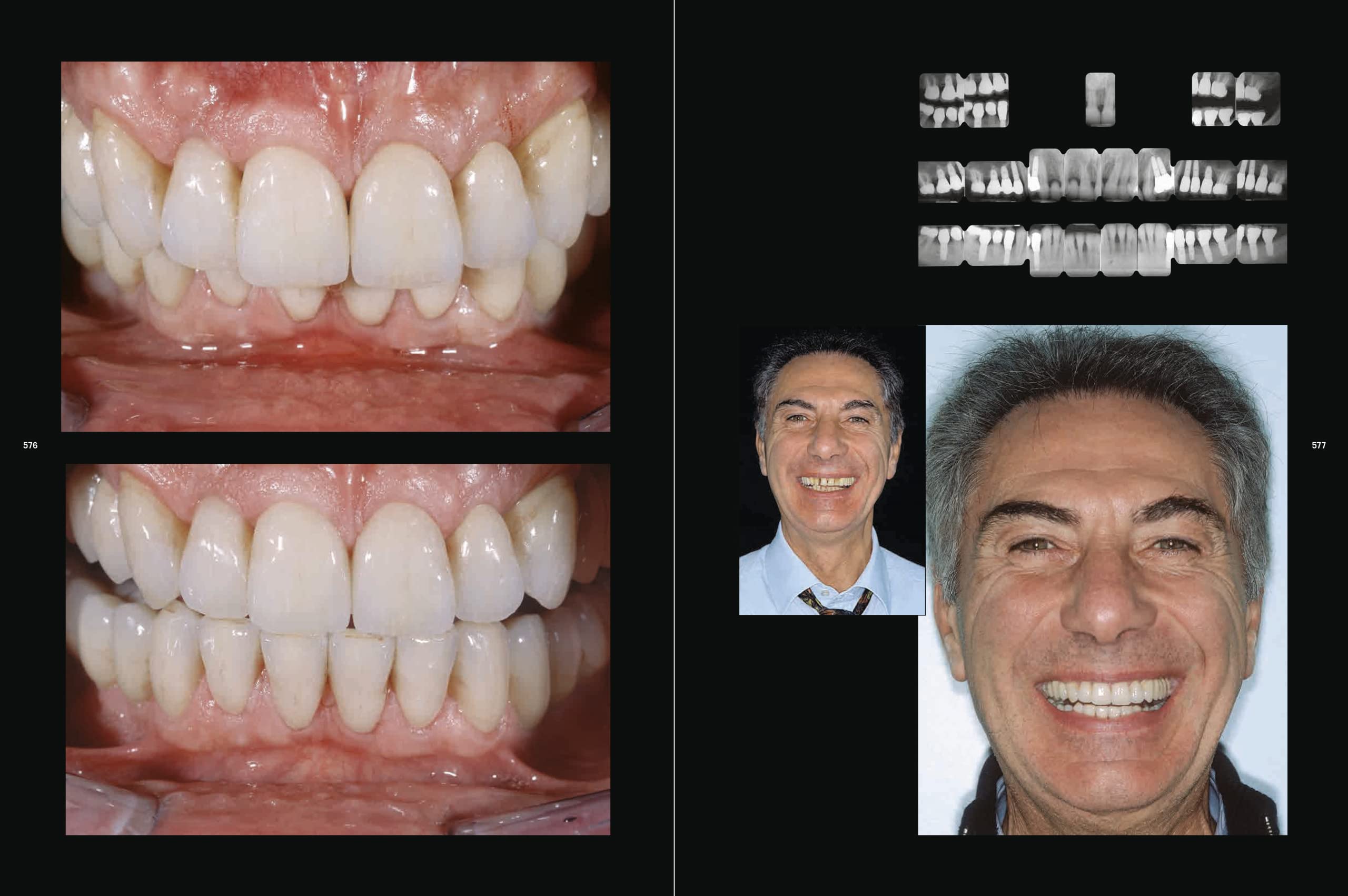 La riabilitazione estetica in protesi fissa (Vol. 2)