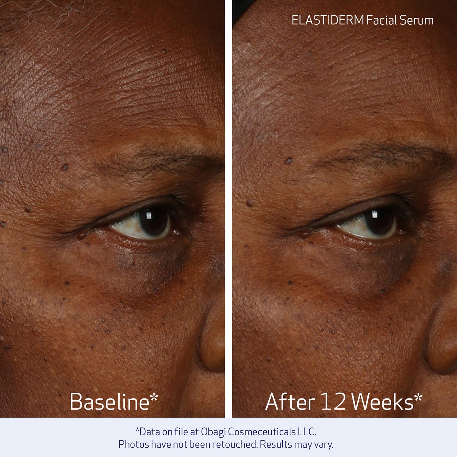 Obagi ELASTIDERM Facial Serum 1oz & Eye Serum .47oz Set – Clinically Proven to Firm Skin, Target Signs of Aging & De-Puff Eyes with Caffeine & Patented Bi-Mineral Contour Complex