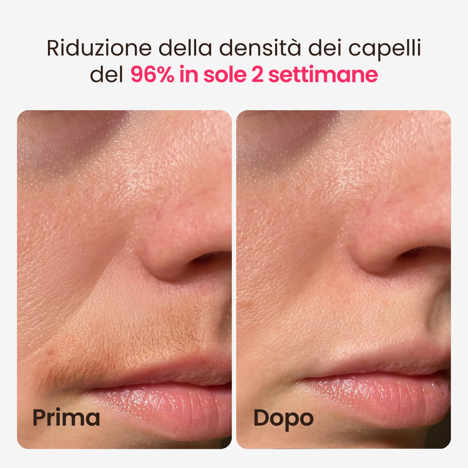 25J Epilatore laser IPL con Triplo Impulso, zaffiro ghiaccio indolore a 3 °C, Epilazione laser definitiva, 999900 impulsi di Luce Pulsata, per Uomo Donna, Ascelle Bikini Corpo,Idea Regalo(oro)