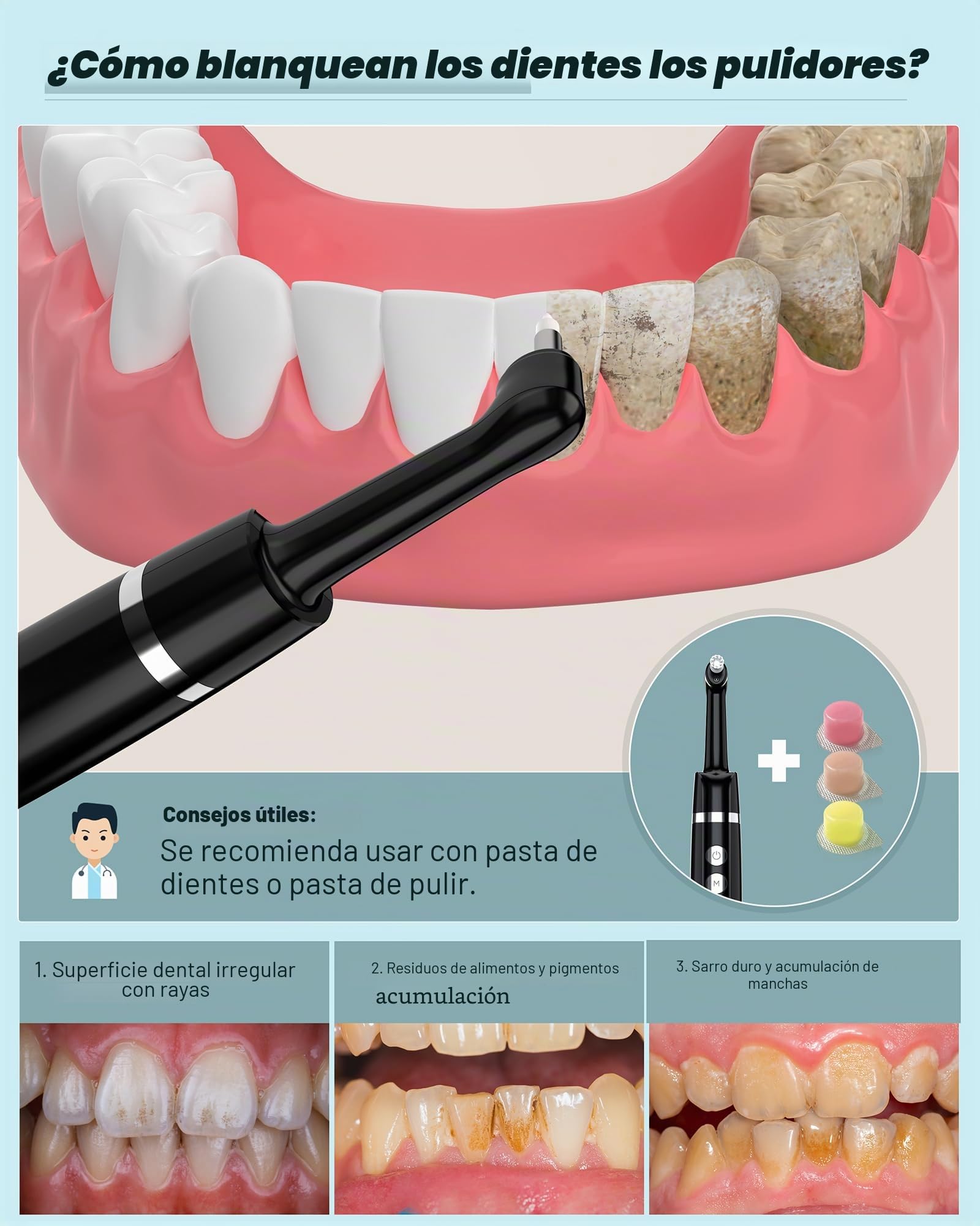 Stim-U-Dent - Juego de blanqueamiento de dientes con 5 modos para limpiar los dientes y blanquear los dientes, para pulir después de la limpieza dental, juego de blanqueamiento dental con 5 cabezales