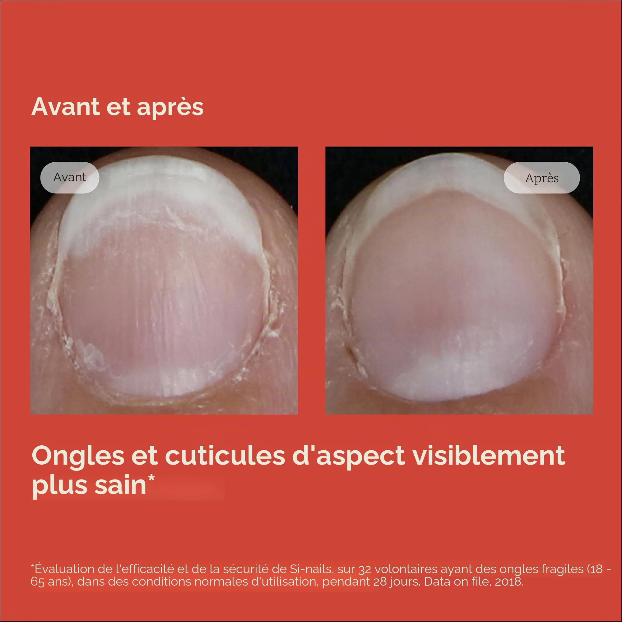 ISDIN Si-Nails Renforçateur pour Ongles Effet Invisible (2,5 ml) | Durcit et Favorise la Croissance | Hydrate les Ongles et les Cuticules | Efficace Même sur le Vernis | Résultats Visibles en 14 Jours