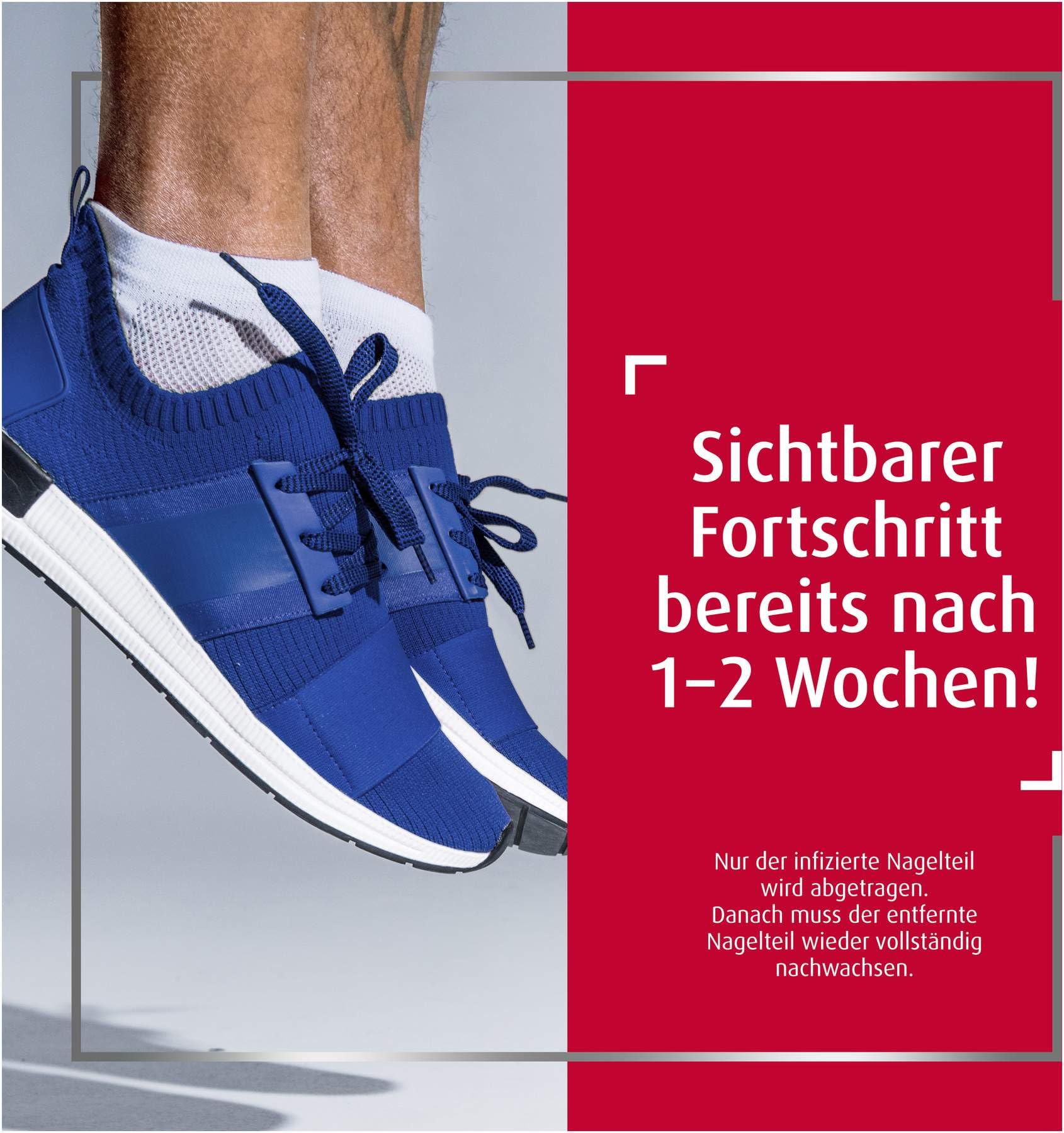 Sparset Canestan Extra Nagelset + Extra 20 g Creme - Vorteilspaket Kombiset