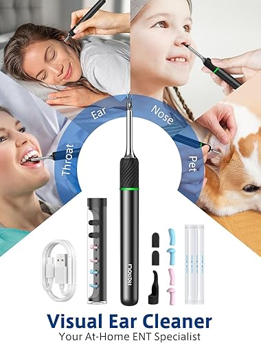 Miniatura 6 de Herramienta de eliminación de cera de oídos con video remoto en tiempo real, kit de eliminación de cera de oídos 3 en 1 con modo de púa y pinzas,