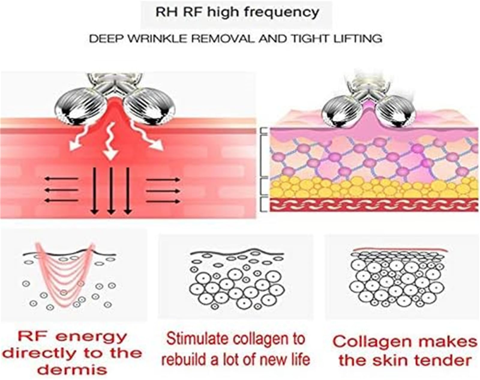 Máquina de belleza reafirmante RF, Equipo de belleza para rejuvenecimiento con masaje por microcorriente de radio para rostro y cuerpo