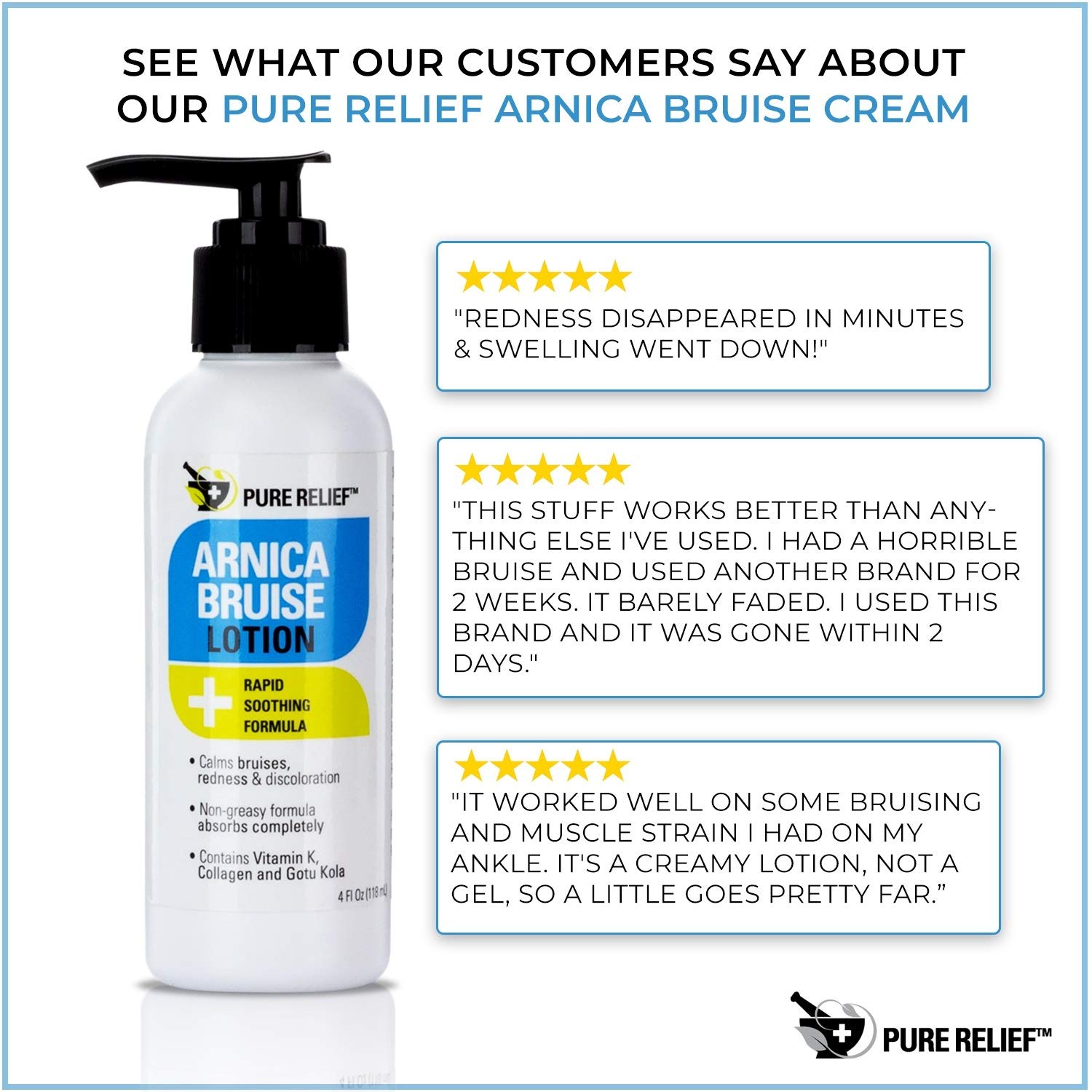 Pure Relief Arnica Bruise Lotion Rapid Relief For Bruising Redness And