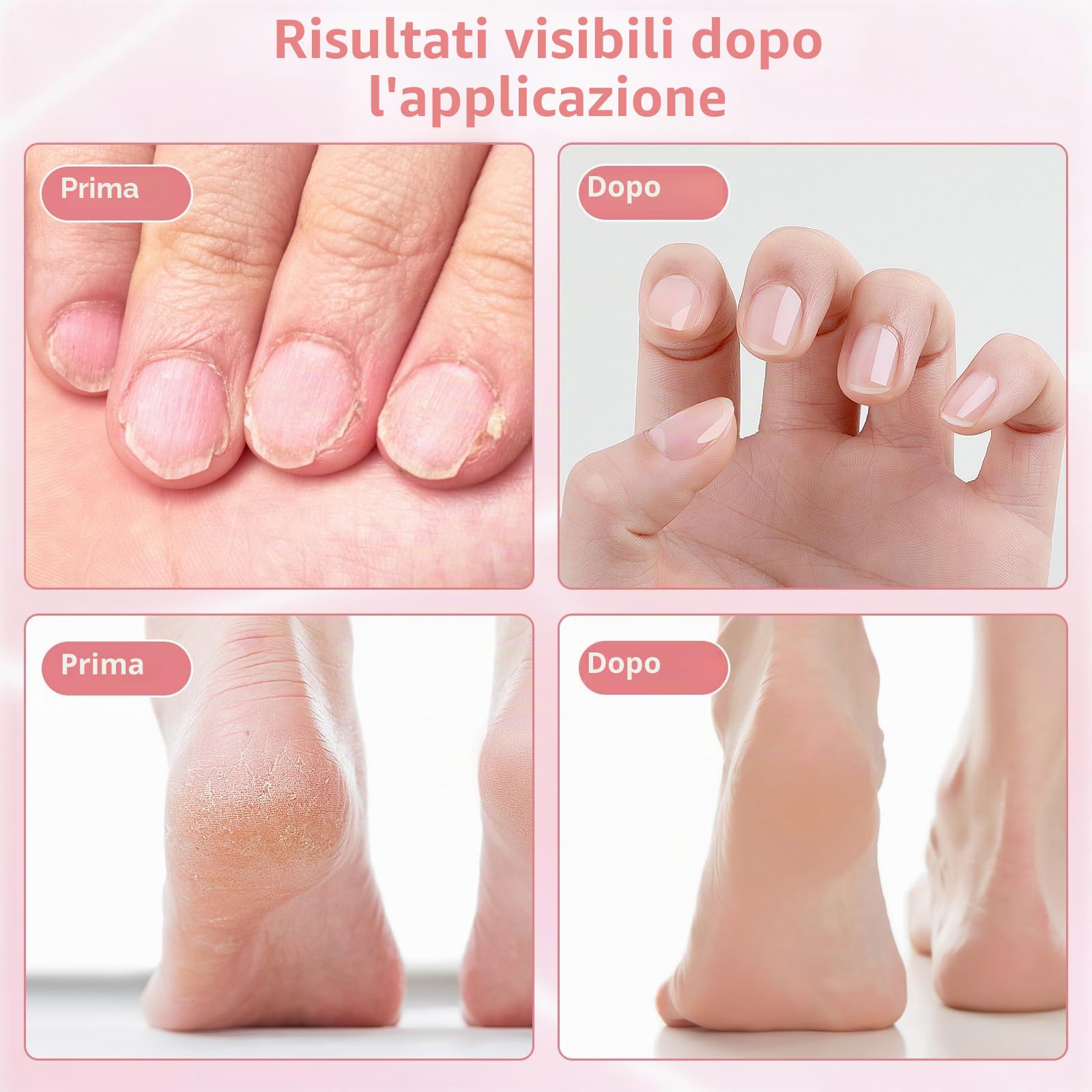 2 in 1 Pedicure Elettrico Professionale Piedi, Rimozione Calli Piedi Elettrico Ricaricabile con Display LCD, 30 Lime Intercambiabili, 9 Velocità di Rimozione dei Calli per Pelle Dura Morta (Oro Rosa)