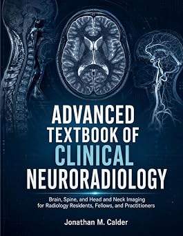 Advanced Textbook Of Clinical Neuroradiology Brain, Spine, and Head and Neck Imaging for Radiology Residents, Fellows, and Practitioners