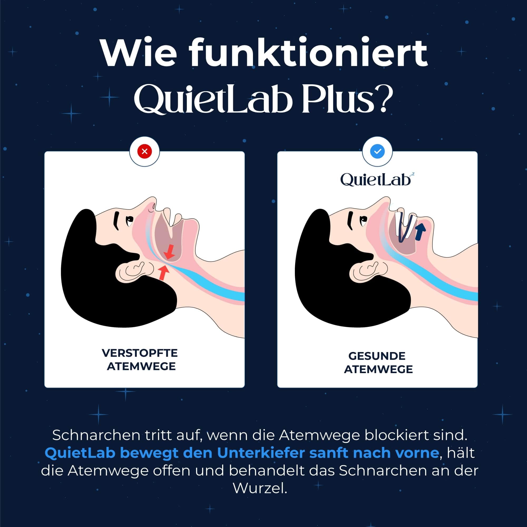 QuietLab Plus 3x Anti Schnarch Mundstück mit Reinigungsbürste, 25 Anpassbare Positionen, Airflow Schnarchstopper Schiene, Anti Schnarchschiene für Männer & Frauen, Anti Snoring Mouthpiece