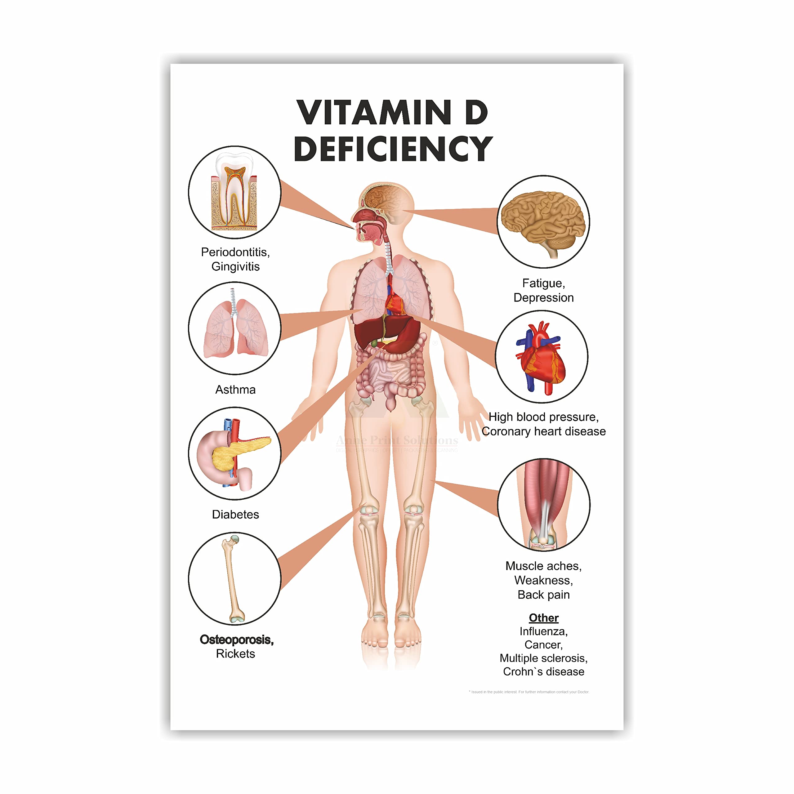 Anne Print SolutionsVitamin D Poster Size 13 Inchx X 19 Inchx (Without Frame) For Hospital Poster, Clinic Poster Pack Of 1 Pcs Multicolour