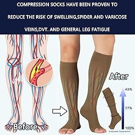 LIN PERFORMANCE 20-30 mmHg Medical Compression Socks for Women and Men Knee High Open Toe Stockings for Varicose Vein Swollen legs (XXL,Khaki)