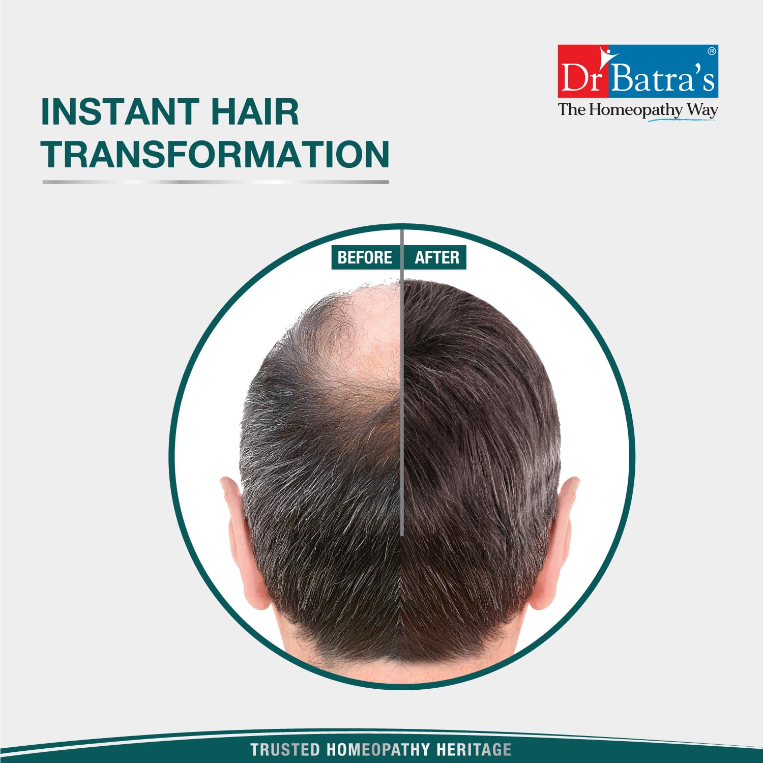 Dr. Batra's Instant Hair Natural Keratin Hair Building Fibre, Dark Brown, 12g