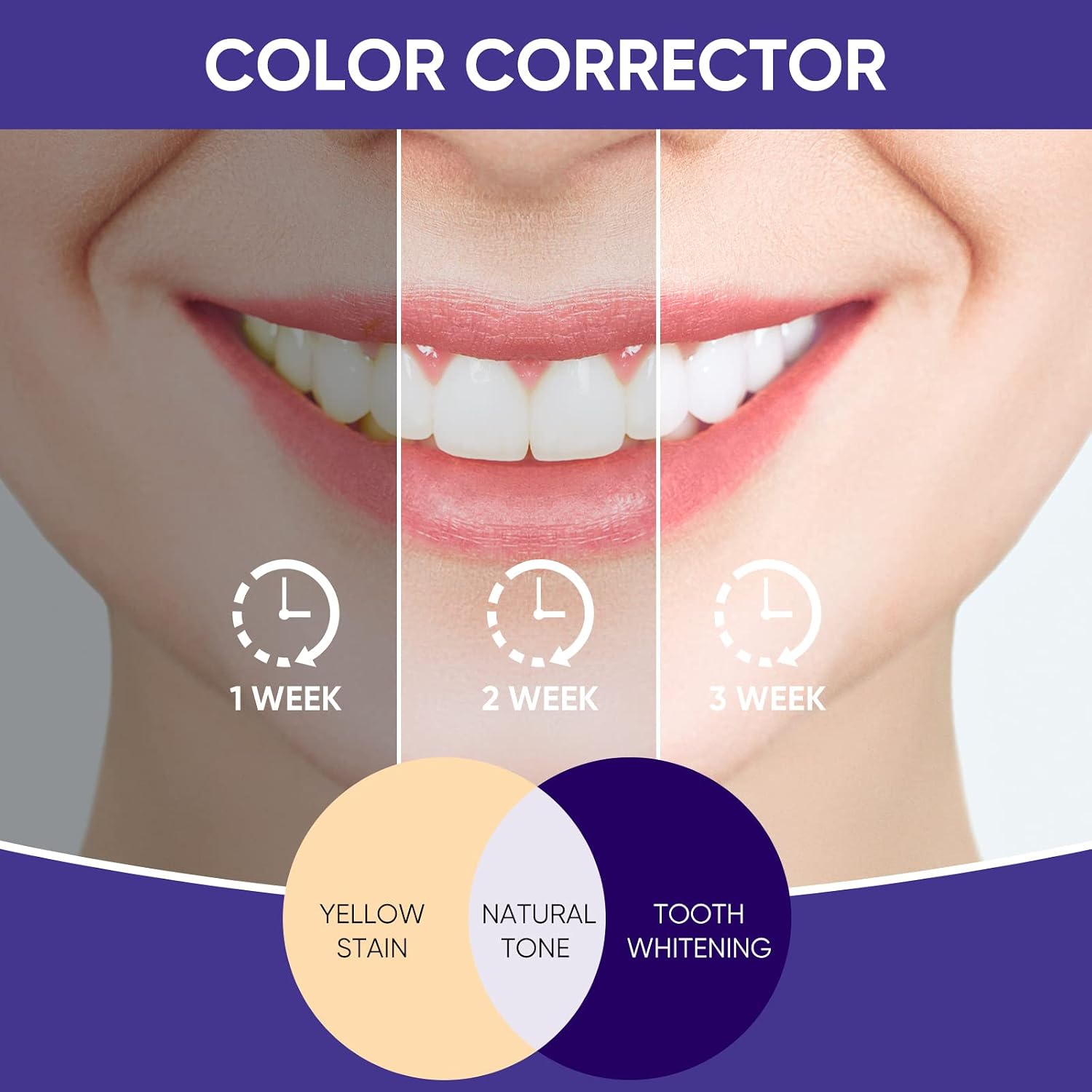Purple Toothpaste for Teeth Whitening, Purple Teeth Whitening - Purple Toothpaste for Tooth Stain Removal & Colour Correcting