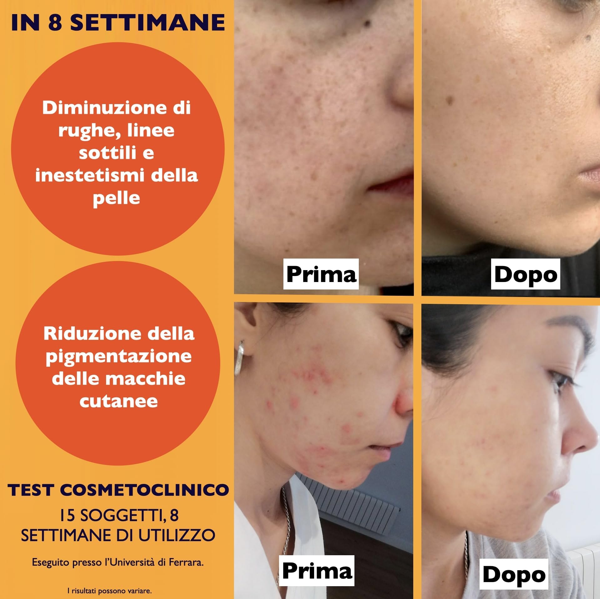 60ml. Bio Siero Vitamina C e Vit. E. Siero Viso Acido Ialuronico Antirughe, Antimacchie Illuminante, e Antietà. Ideale Come Crema Contorno Occhi e per Dermaroller. Biologico,Vegano