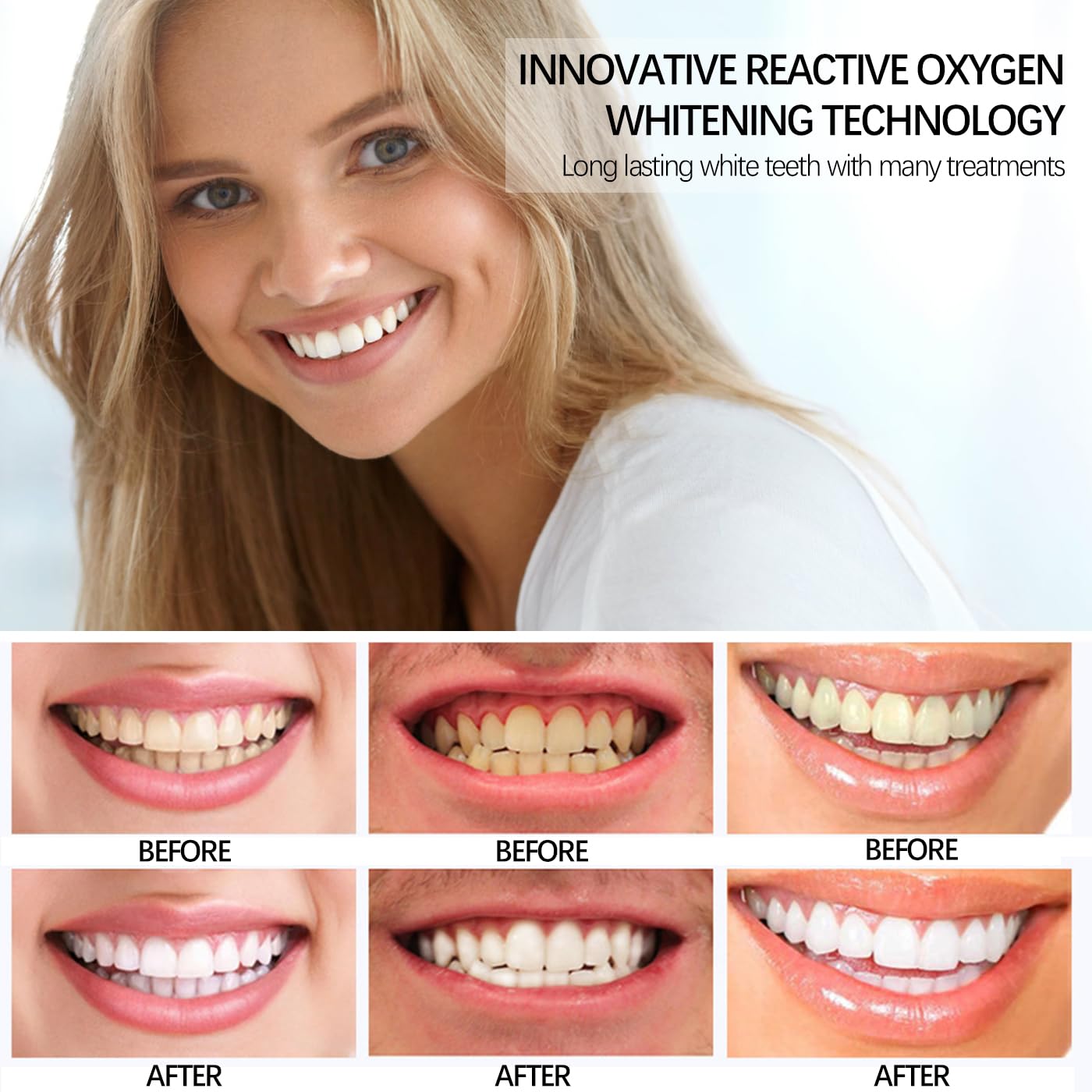AYNKH 14 set di 28 strisce dentali sbiancanti per rimuovere le macchie di caffè affumicato, DENTAL Whitening Kit dentale whitenizer 3D White Strips con strumento di pulizia