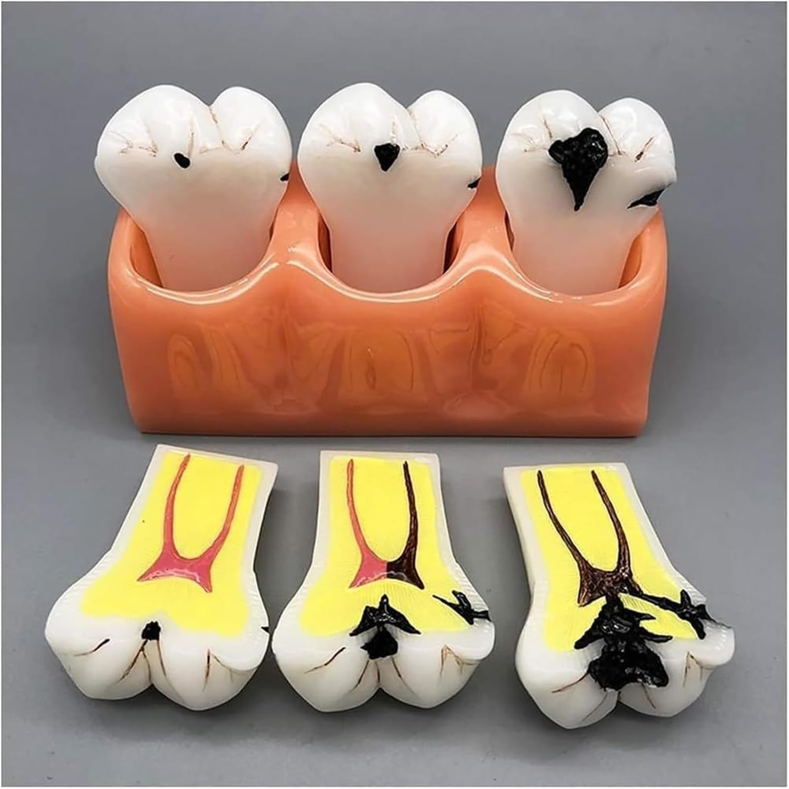 Standardowy model zębów dla dorosłych dentystów, realistyczny projekt symulacji i doskonałe wykonanie do nauczania, akcesoria do próchnicy zębów dla dentystów, nauczycieli uczniów nauczania anatomii
