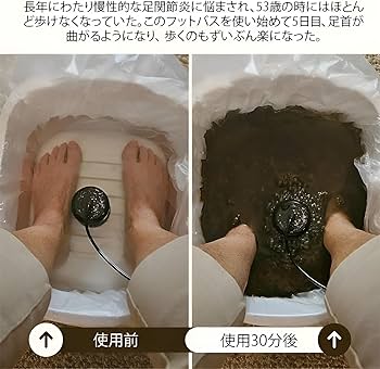 Amazon.co.jp: [koulaya]「毒素と重金属の除去」イオンフットバス