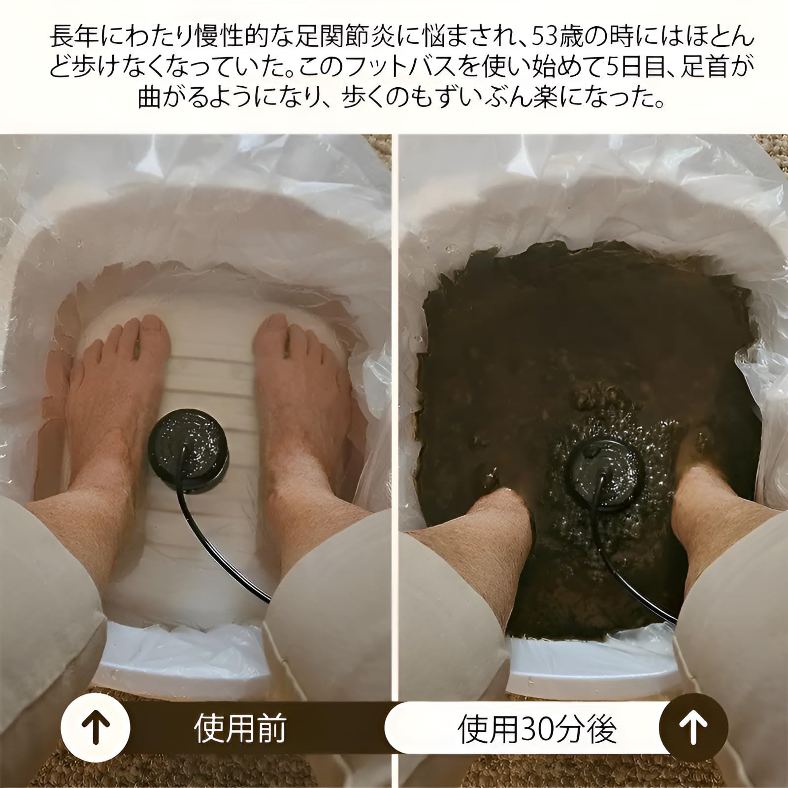 Amazon.co.jp: [koulaya]「毒素と重金属の除去」イオンフットバス