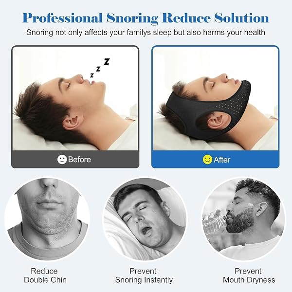 Mentonnière Anti Ronflement,Anti Ronflement Efficace Puissant,Mentonnière De Sommeil En Respirante,Solution Ronflements Réglable Mentonnière pour Aide Réduction Ronflement,ince et léger (Black) - 2
