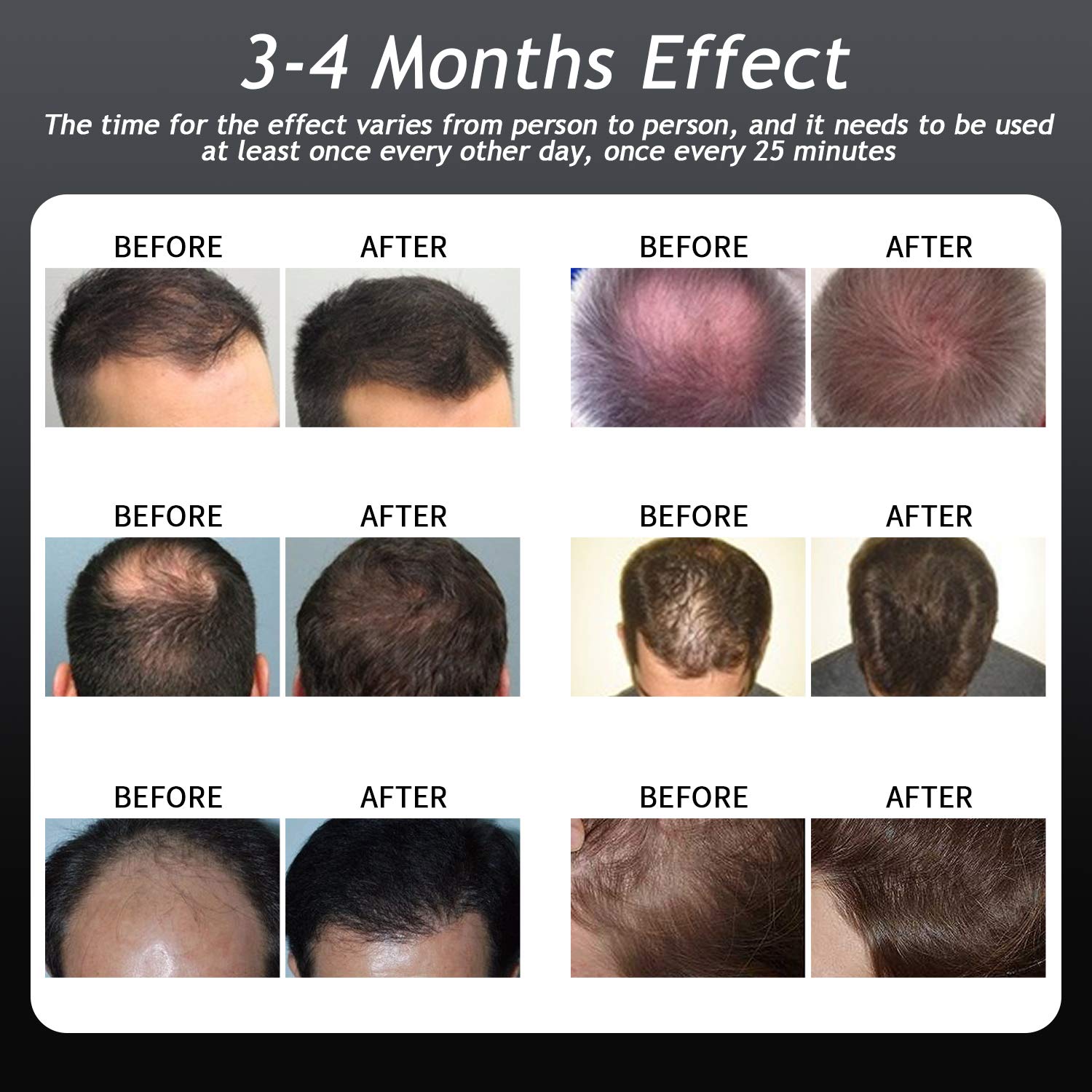 CNV Laser Hair Growth System,Hair Regrowth for Men and Women Device,168