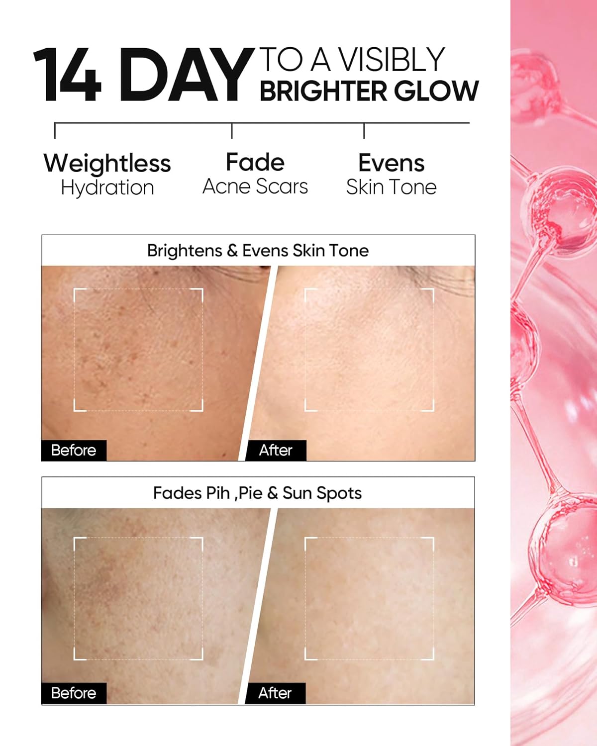 10% Niacinamide Serum with Niacinamide Brightening Cream for Face