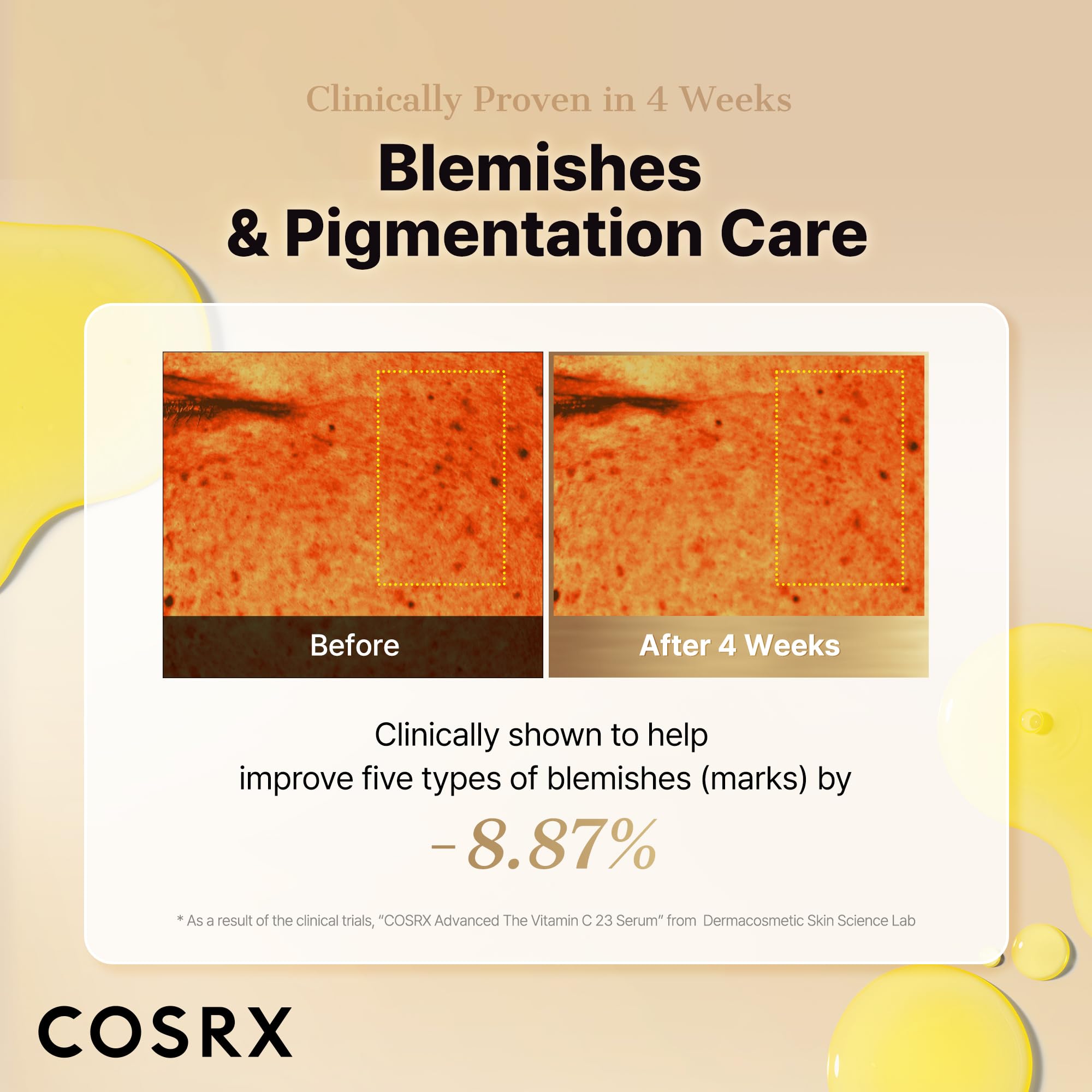 COSRX Advanced Pure Vitamin C 23% Serum with Vitamin E & Glutathione (Renewal), Korean Vitamin C Serum for Fine Lines, Uneven Skin Tone & Dull Skin, 0.67oz, Korean Skin Care