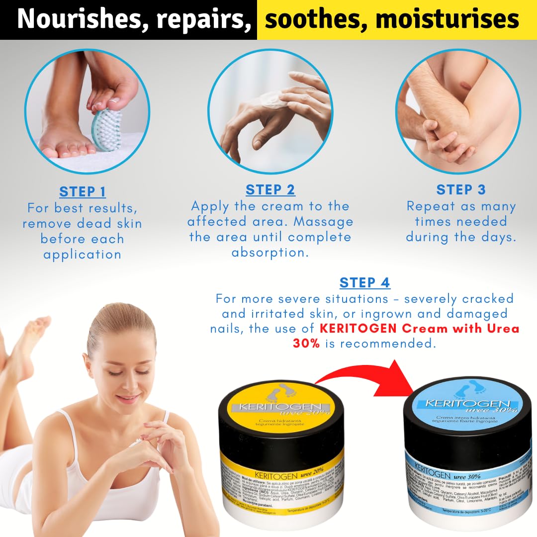 Crema Urea 20%, Eczemi, Cheratosi, Psoriasi, Eruzioni Cutanee, Riduce il Prurito, Sechezza, Pelle Secca e Screpolata, Calli, Duroni, Desquamazioni,- Cocos e Olio d'Oliva, 50g