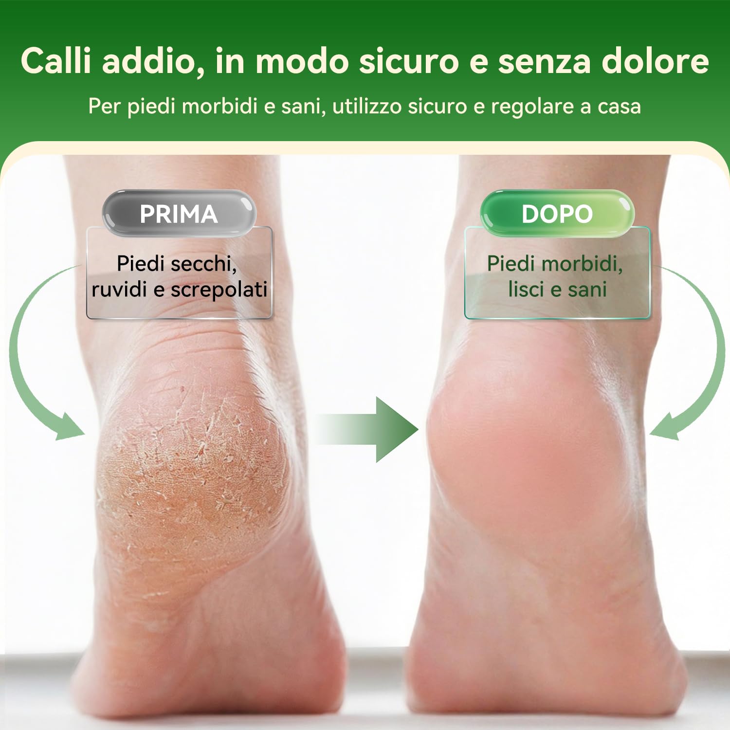 SHORAN Pedicure Elettrico Professionale Piedi, Rimuovi Duroni e Calli Piedi Rimozione Ricaricabile per Eliminare Gratta Togli Leviga Cura Pelle morta e Talloni screpolati, con 3 Rulli e 2 Raspa Piedi