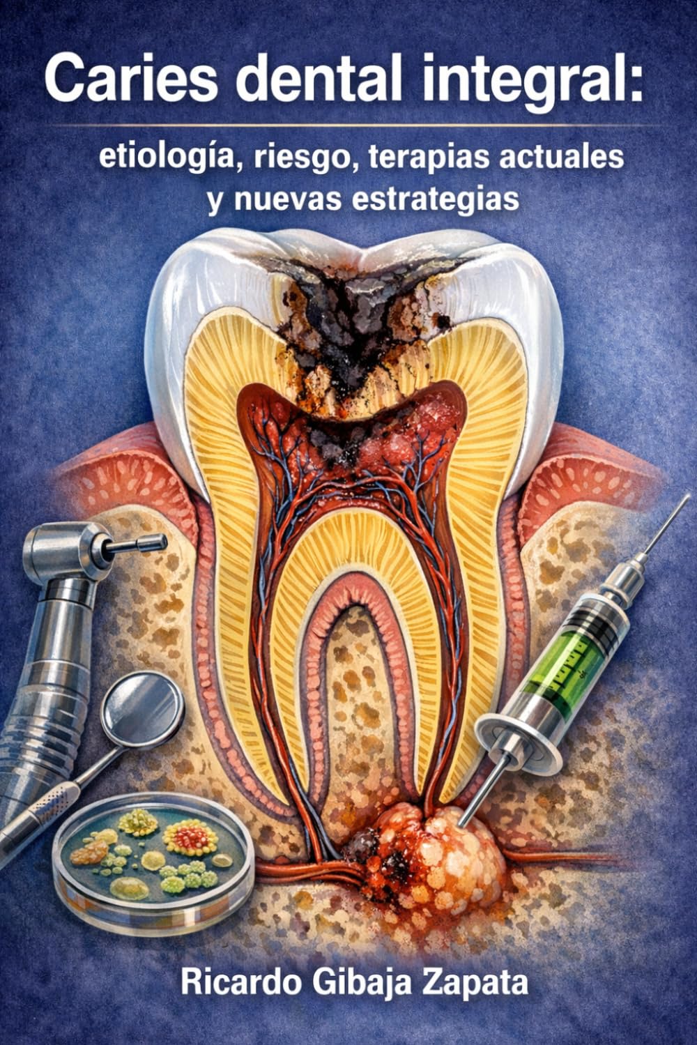 Caries dental integral: etiología, riesgo, terapias actuales y nuevas estrategias