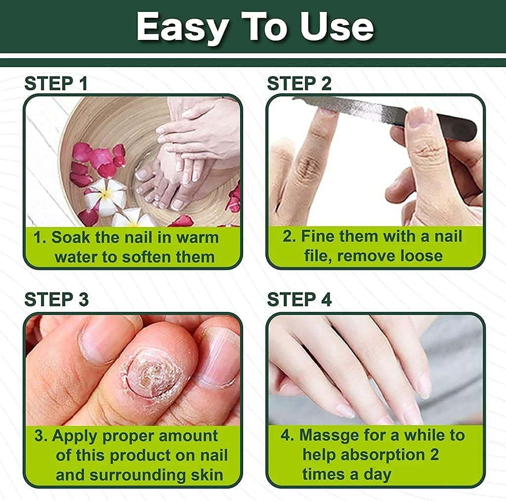 Efero Nail Repair Essence Gel, Toe Be Health Instant Beauty Gel, Toenail Treatment Cure Under The Nail, Nail Repair Cream for Damaged Nail, Restores Appearance of Discolored or Damaged Nails (2 pcs) : Beauty & Personal Care