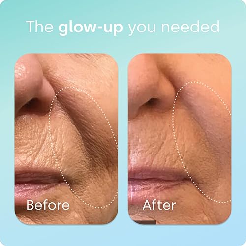 Miniatura 4 de Biosil Healthy Aging - 60 cápsulas - Belleza, vitalidad y apoyo de la tiroides - con Ch-OSA y selenio patentados - 60 porciones