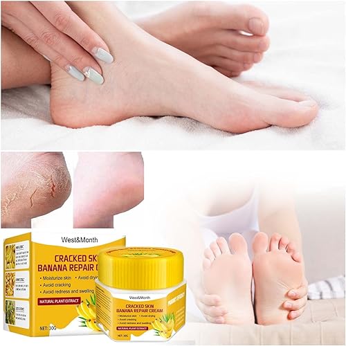 1 crema para pies hidrata e hidrata el cuidado del callo crema para tratamiento de uñas de los pies disponible en Yaxa Colombia