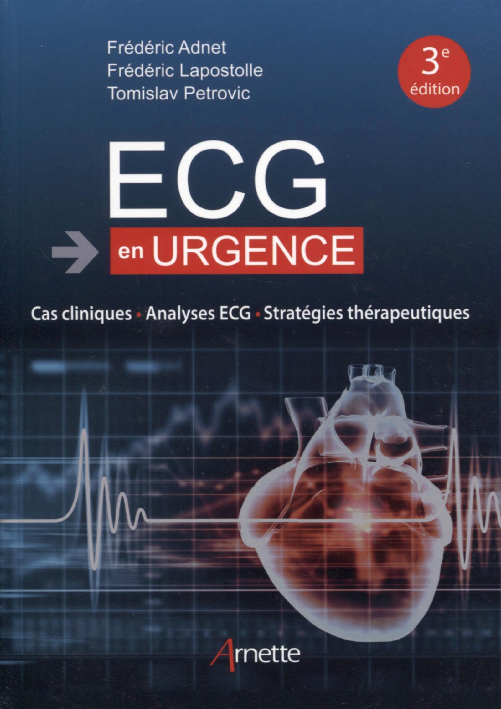 ECG - En Urgence: Cas cliniques - Analyses ECG - Stratégies thérapeutiques