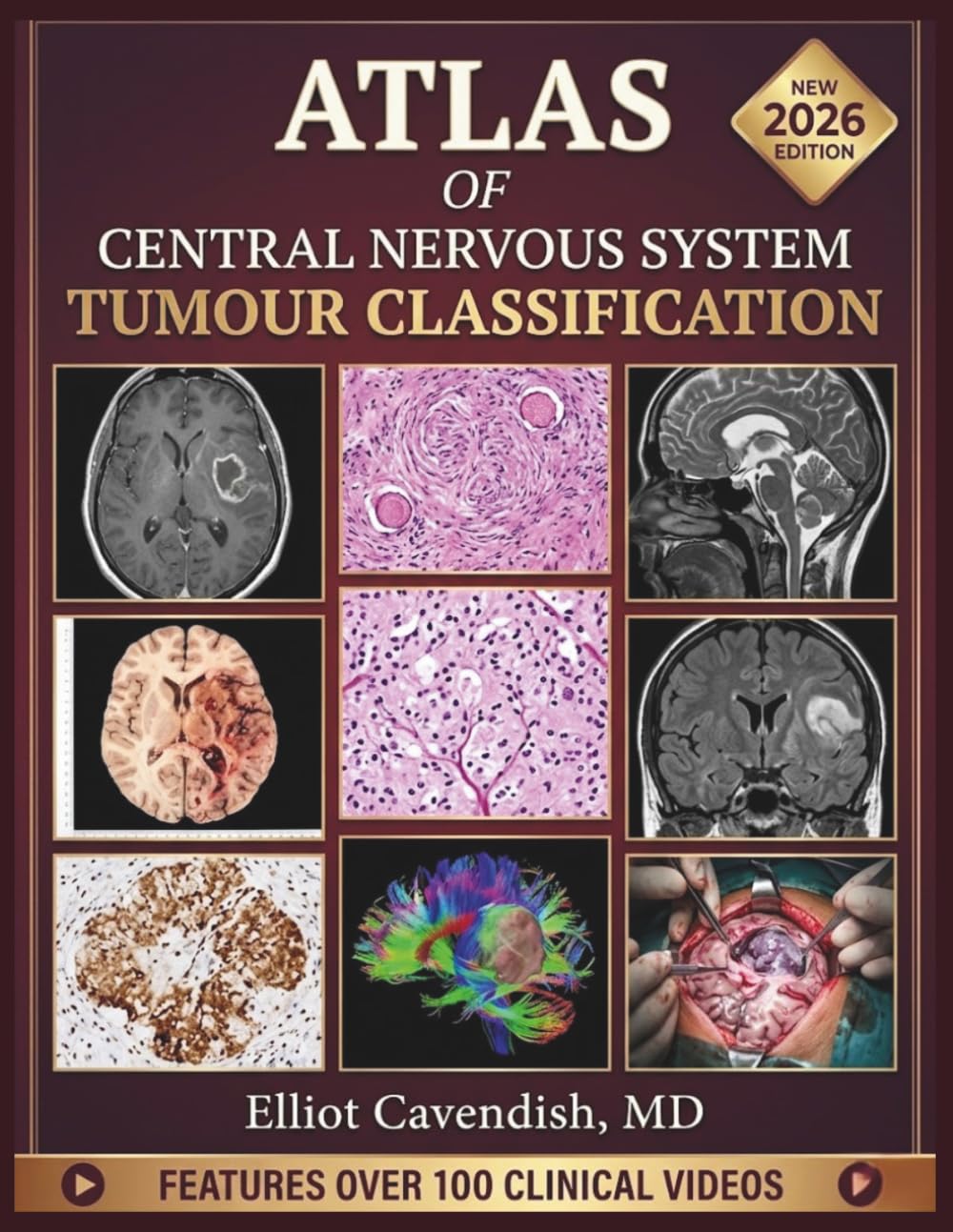 ATLAS OF CENTRAL NERVOUS SYSTEM TUMOUR CLASSIFICATION: A Comprehensive Guide to Histopathology, Molecular Pathology, Diagnostic Criteria, Grading, and Clinical Management