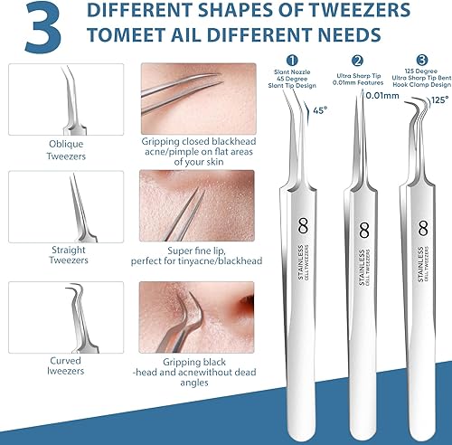 Miniatura 4 de Kit de herramientas para eliminar puntos negros, herramienta extractora de espinillas, herramienta extractora de espinillas, herramienta profesional