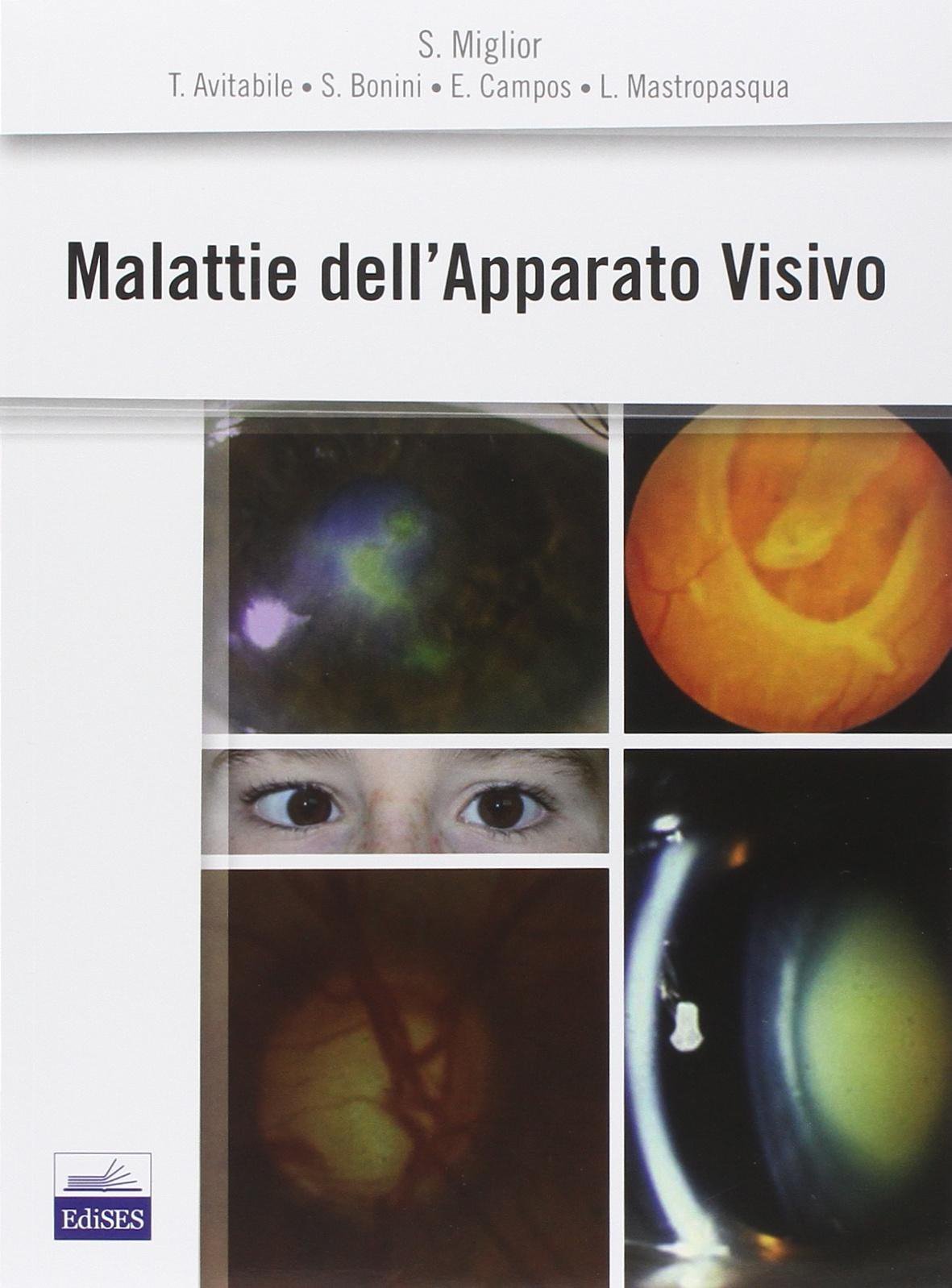 Malattie dell'apparato visivo