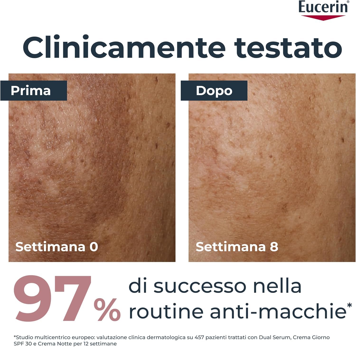Eucerin Anti-Pigment Crema Viso Giorno SPF30 50 ml, Crema antimacchie viso per una pelle più uniforme e luminosa, Formula arricchita con SPF 30, filtri UV e Thiamidol per tutti i tipi di pelle
