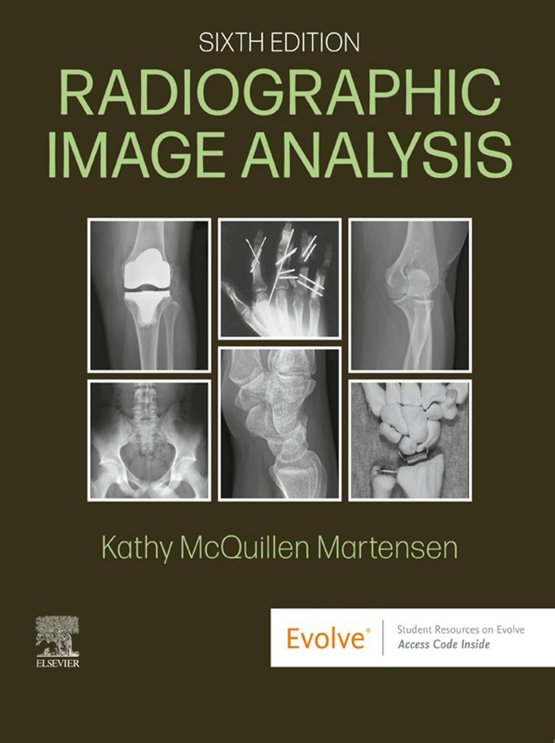 Radiographic Image Analysis - E-Book