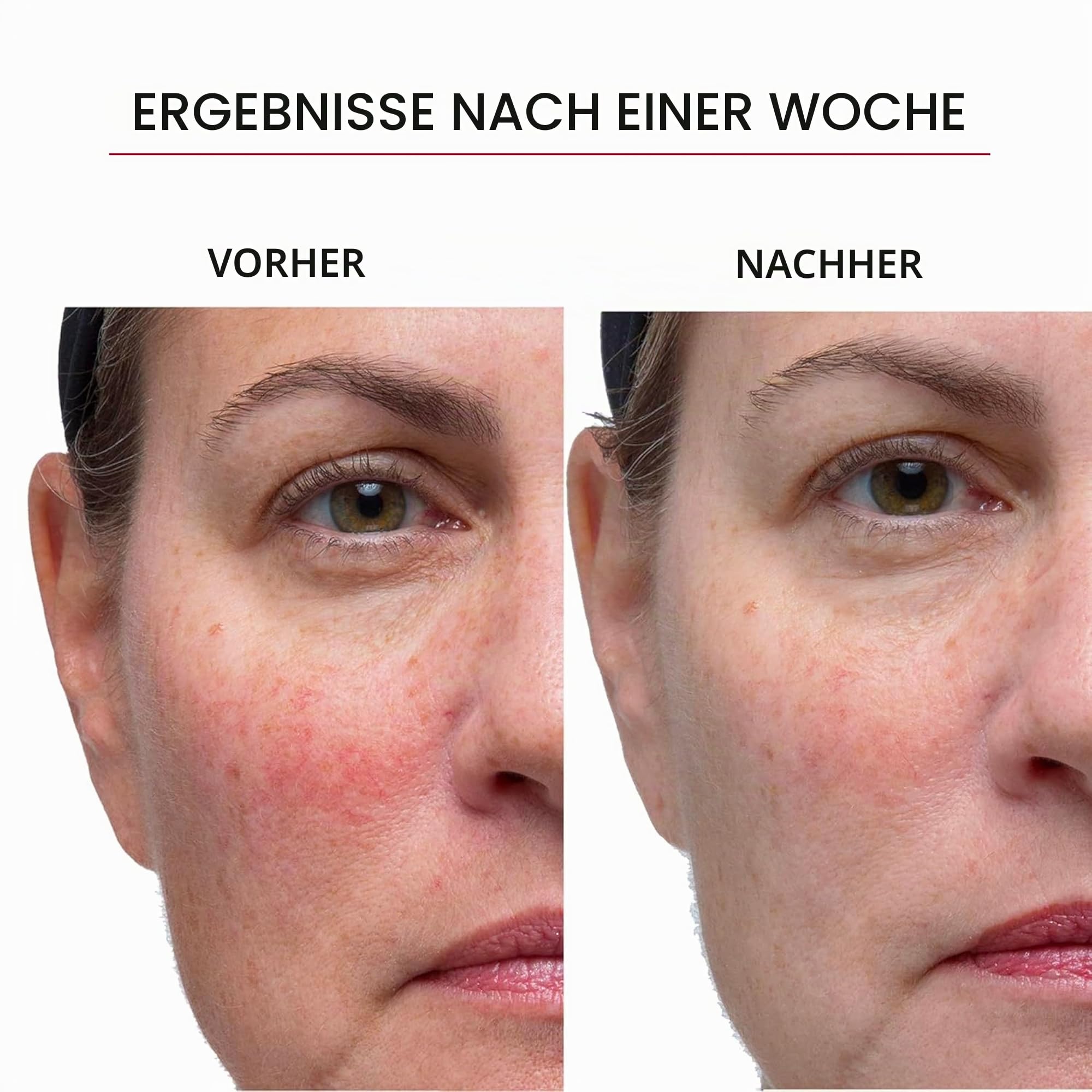 Hey Honey Skincare Good Morning Gesichtsserum für reife Haut | Schnell wirkender Hautbefeuchter und Schutz der Hautbarriere | Mit Hyaluronsäure, Retinyl | Für empfindliche Haut
