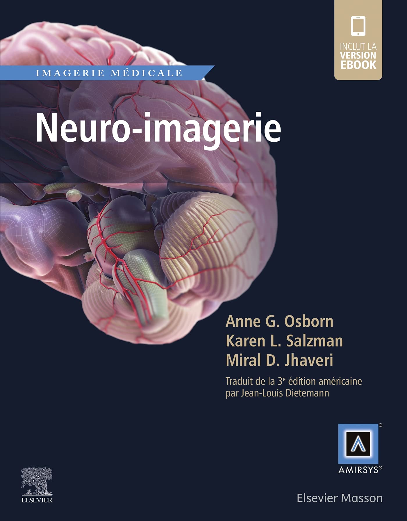 Neuro-imagerie
